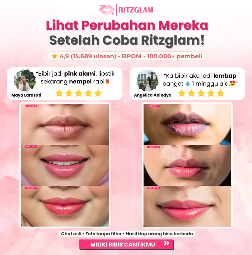 Before after RitzGlam Lip Care – bibir kering berubah jadi pink natural dan lembap hanya dalam 7 hari