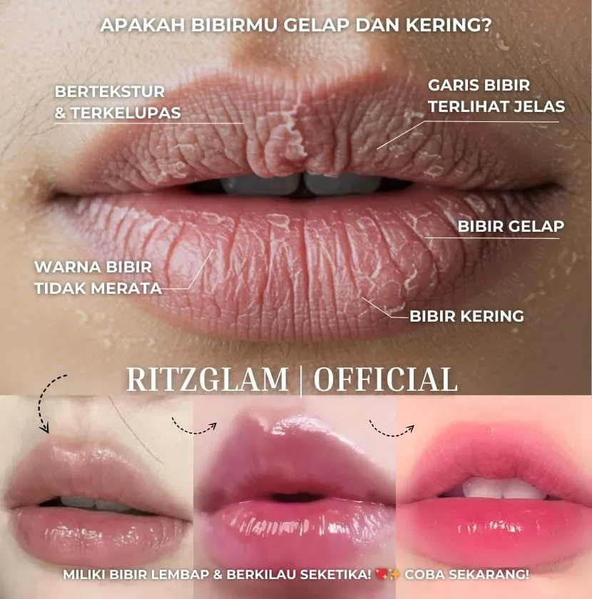 Before after RitzGlam – solusi bibir gelap, kering, dan pecah-pecah jadi lembap, cerah, dan glowing.