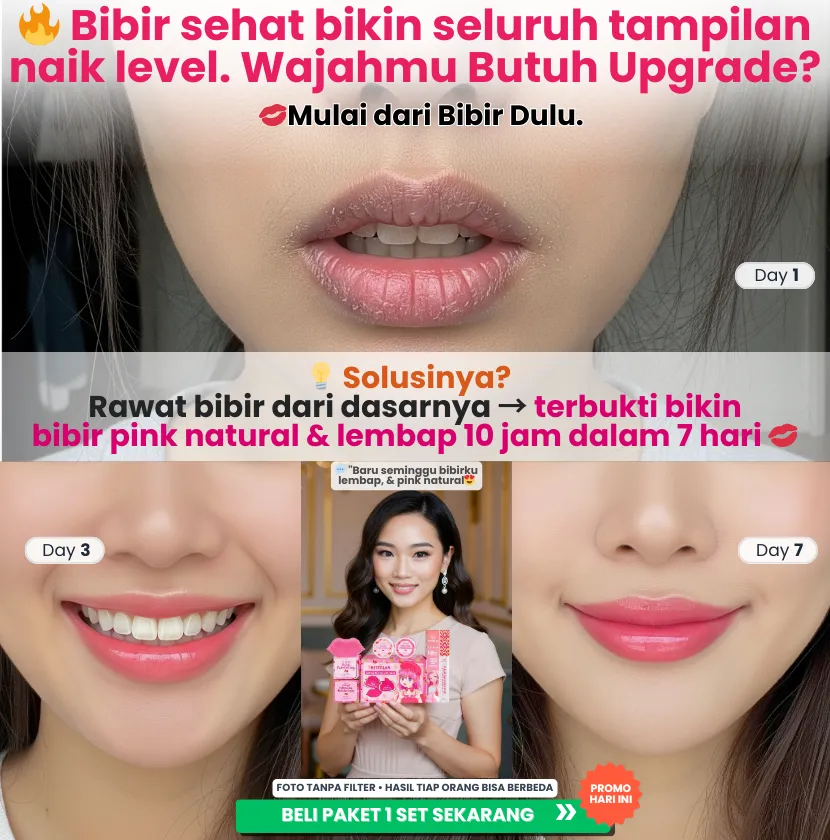 Before After RitzGlam Lip Care – Bibir pink natural dan lembap 10 jam hanya dalam 7 hari