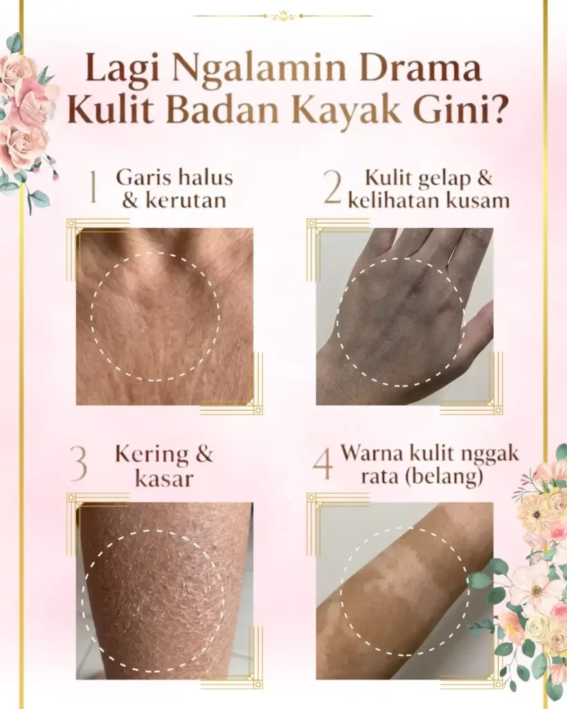 4 masalah umum kulit badan: garis halus, kulit kusam, kering bersisik, dan warna kulit tidak rata (belang)