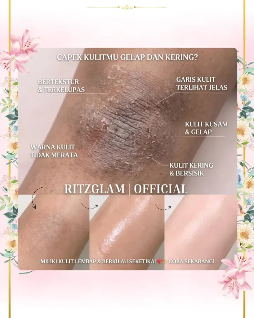 Transformasi kulit sebelum dan sesudah menggunakan RitzGlam: mengatasi masalah kulit gelap, kering, bersisik, dan bertekstur menjadi kulit lembap, halus, dan berkilau seketika.